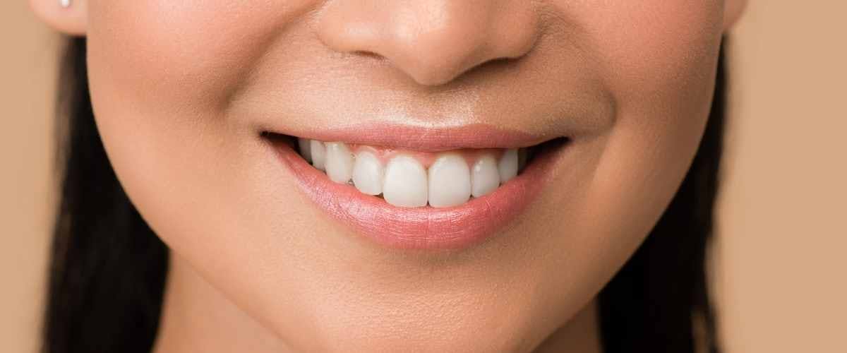 Teeth Whitening in London: In-Office vs. Take-Home Trays, Which Is Right for You?